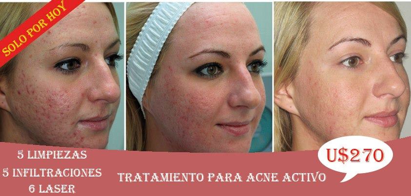 estetic center limpieza facial tratamiento